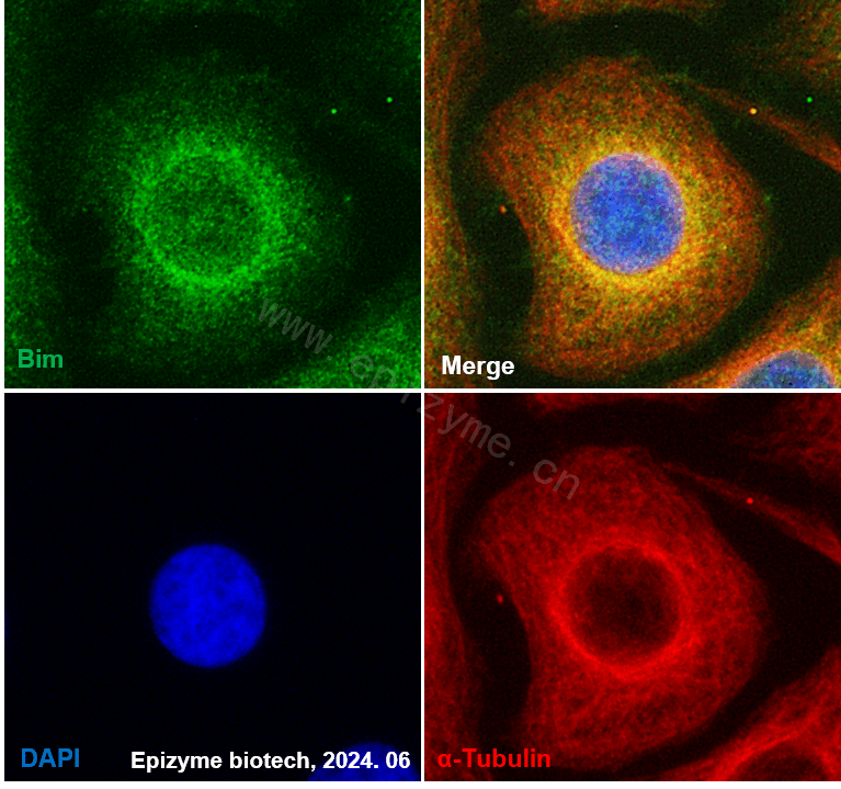 Anti-Bim Rabbit mAb [40M15L92]