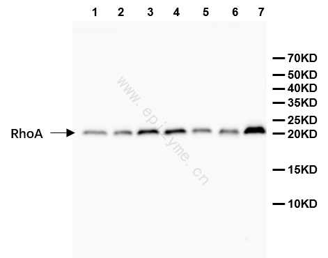 Anti-RhoA Rabbit mAb [80H91L19]