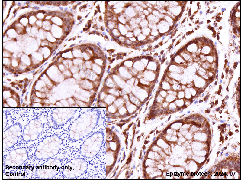 Anti-RhoA Rabbit mAb [80H91L19]