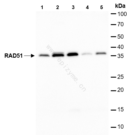 Anti-Rad51 Rabbit mAb [20M21C31]