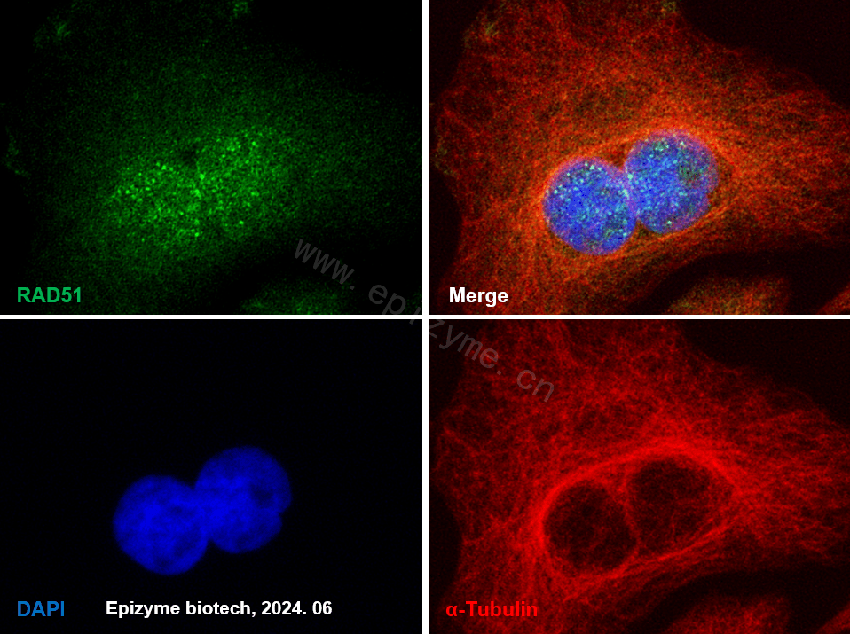 Anti-Rad51 Rabbit mAb [20M21C31]