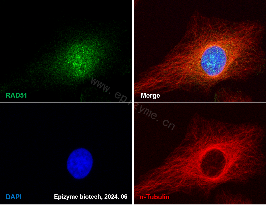 Anti-Rad51 Rabbit mAb [20M21C31]
