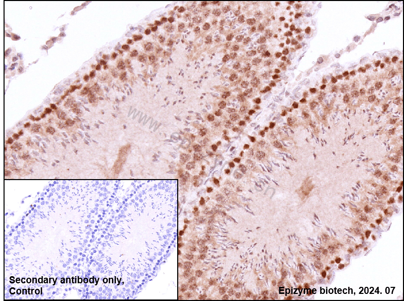 Anti-Rad51 Rabbit mAb [20M21C31]