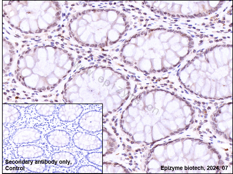 Anti-Rad51 Rabbit mAb [20M21C31]