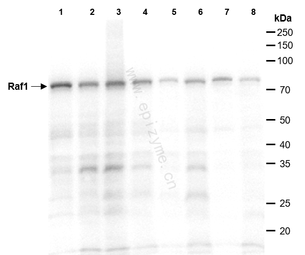 Anti-Raf1 Rabbit mAb [40H36A91]