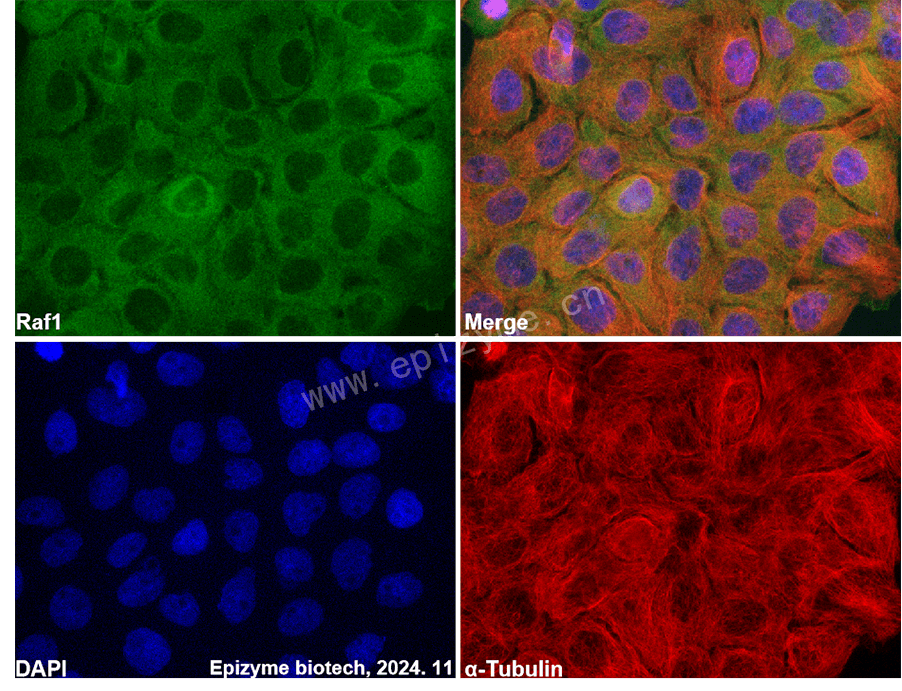 Anti-Raf1 Rabbit mAb [40H36A91]