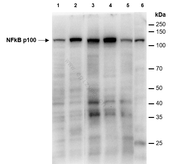 Anti-NF-KB p100 Rabbit mAb [32G01L91]