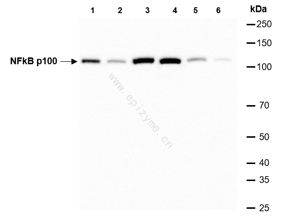 Anti-NF-KB p100 Rabbit mAb [32G01L91]