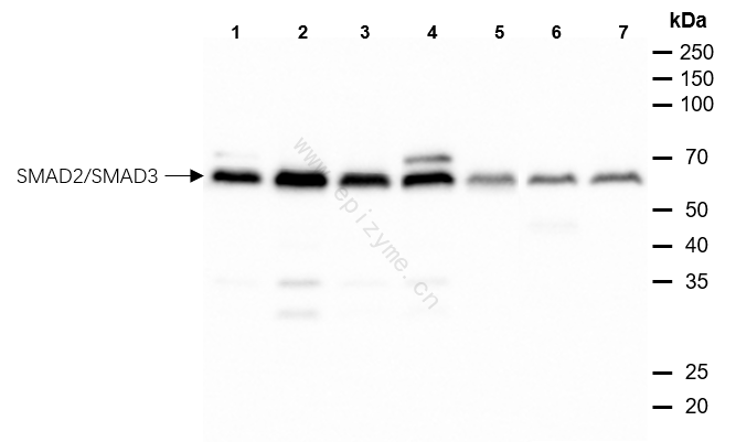Anti-Smad2/3 Rabbit mAb [14L86C22]