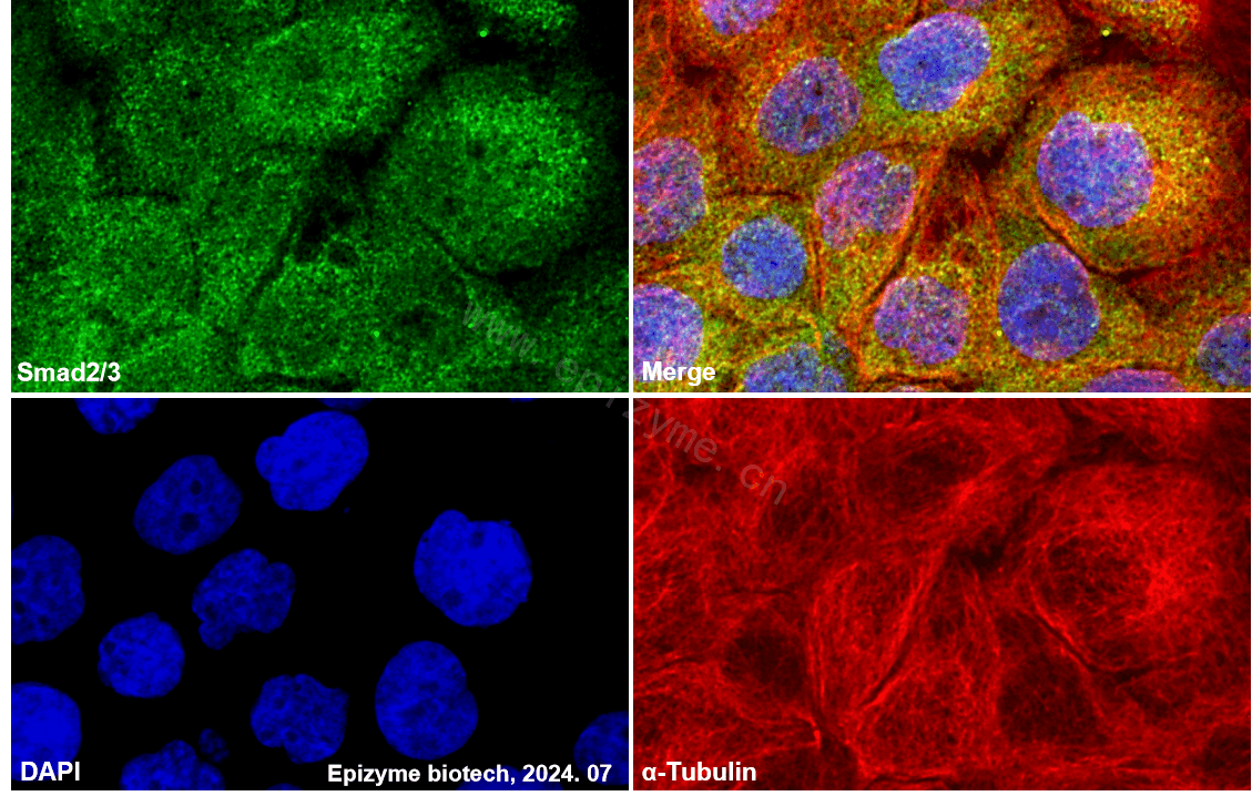 Anti-Smad2/3 Rabbit mAb [14L86C22]