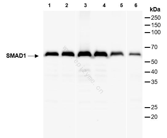 Anti-Smad1 Rabbit mAb [28D91L21]