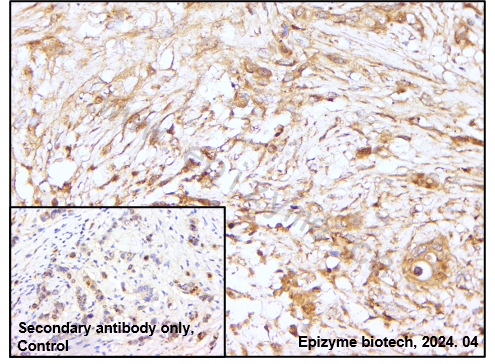 Anti-Smad1 Rabbit mAb [28D91L21]
