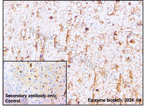 Anti-Smad1 Rabbit mAb [28D91L21]