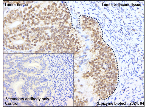 Anti-Smad1 Rabbit mAb [28D91L21]