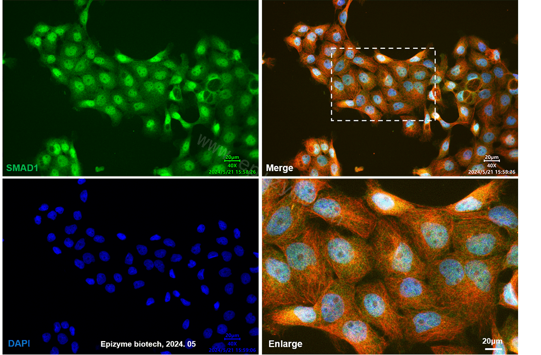 Anti-Smad1 Rabbit mAb [28D91L21]