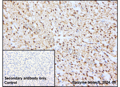 Anti-c-Fos Rabbit mAb [23F93A38]