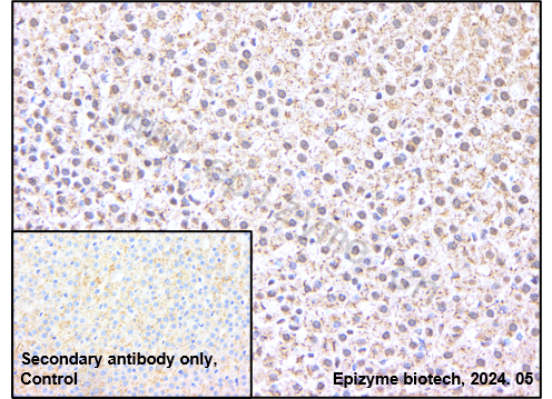 Anti-c-Fos Rabbit mAb [23F93A38]