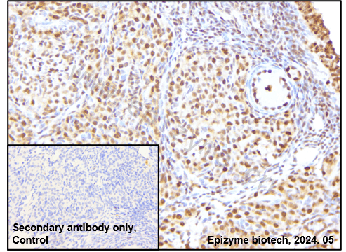 Anti-p27 Kip 1 Rabbit mAb [43G09L12]