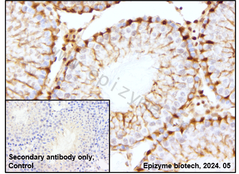 Anti-p27 Kip 1 Rabbit mAb [43G09L12]