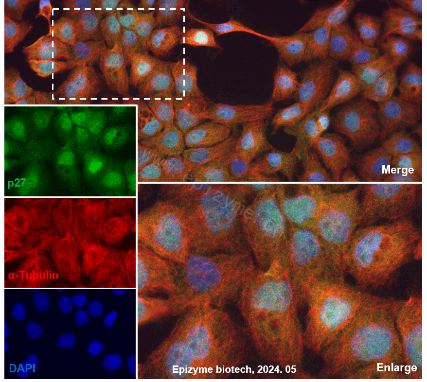 Anti-p27 Kip 1 Rabbit mAb [43G09L12]