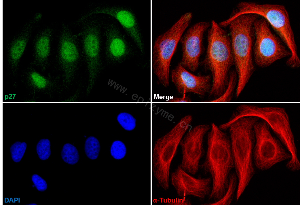Anti-p27 Kip 1 Rabbit mAb [43G09L12]