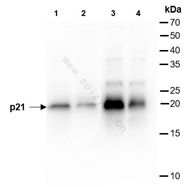 Anti-p21 Rabbit mAb [94C02G12]