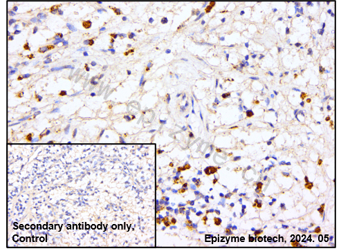 Anti-Phospho-p38 (Thr180/Tyr182) Rabbit mAb [31K99C12]