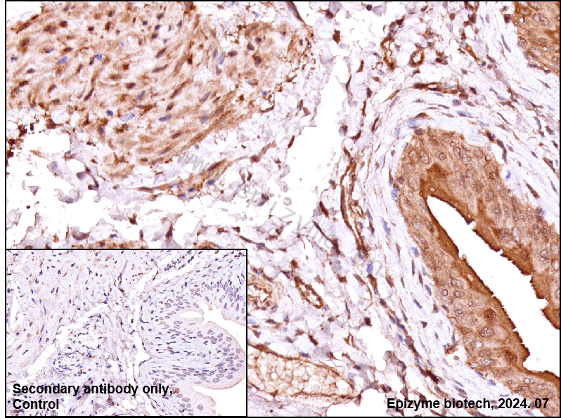 Anti-APC Rabbit mAb [39M01D02]