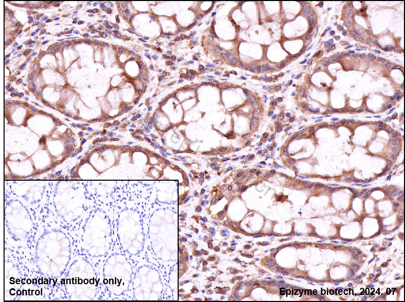 Anti-APC Rabbit mAb [39M01D02]