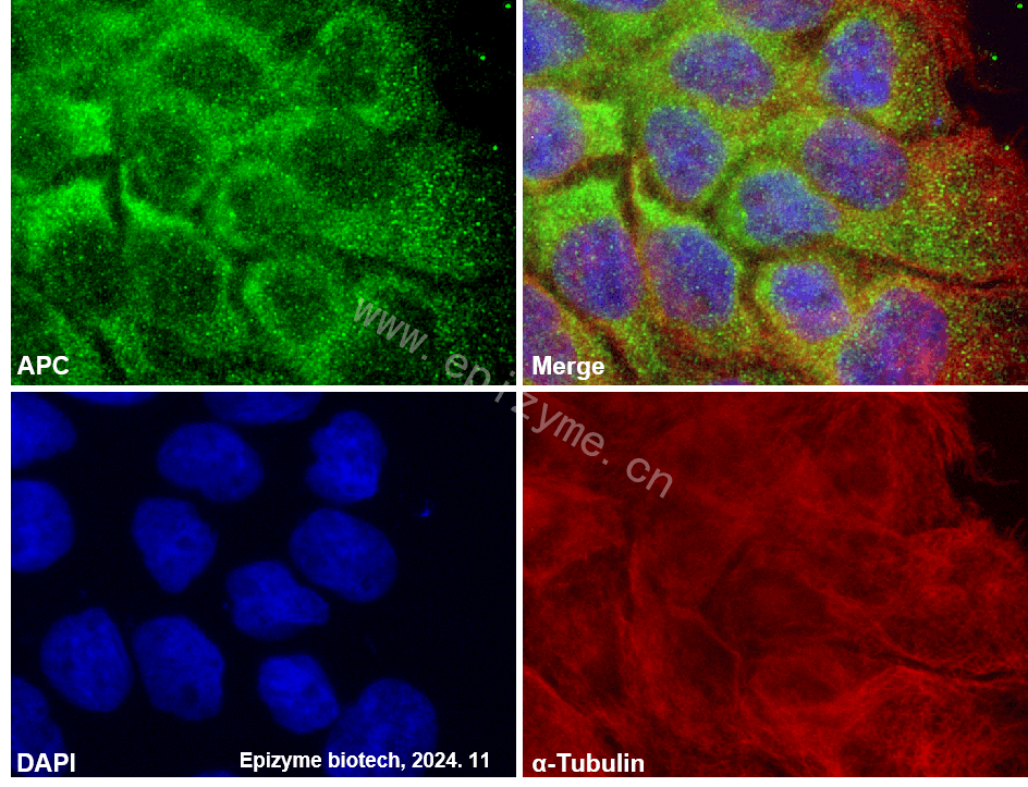Anti-APC Rabbit mAb [39M01D02]