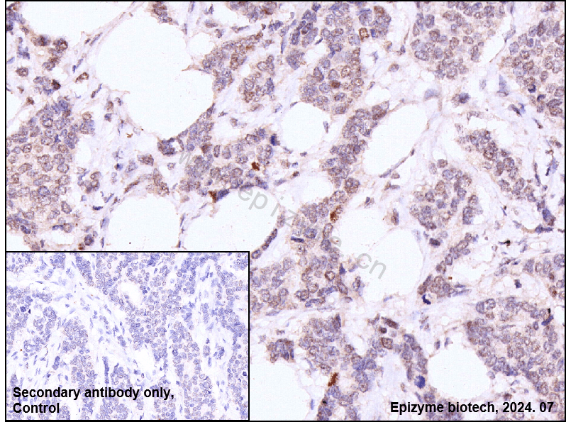 Anti-c-Fos Rabbit mAb [54L91B78]