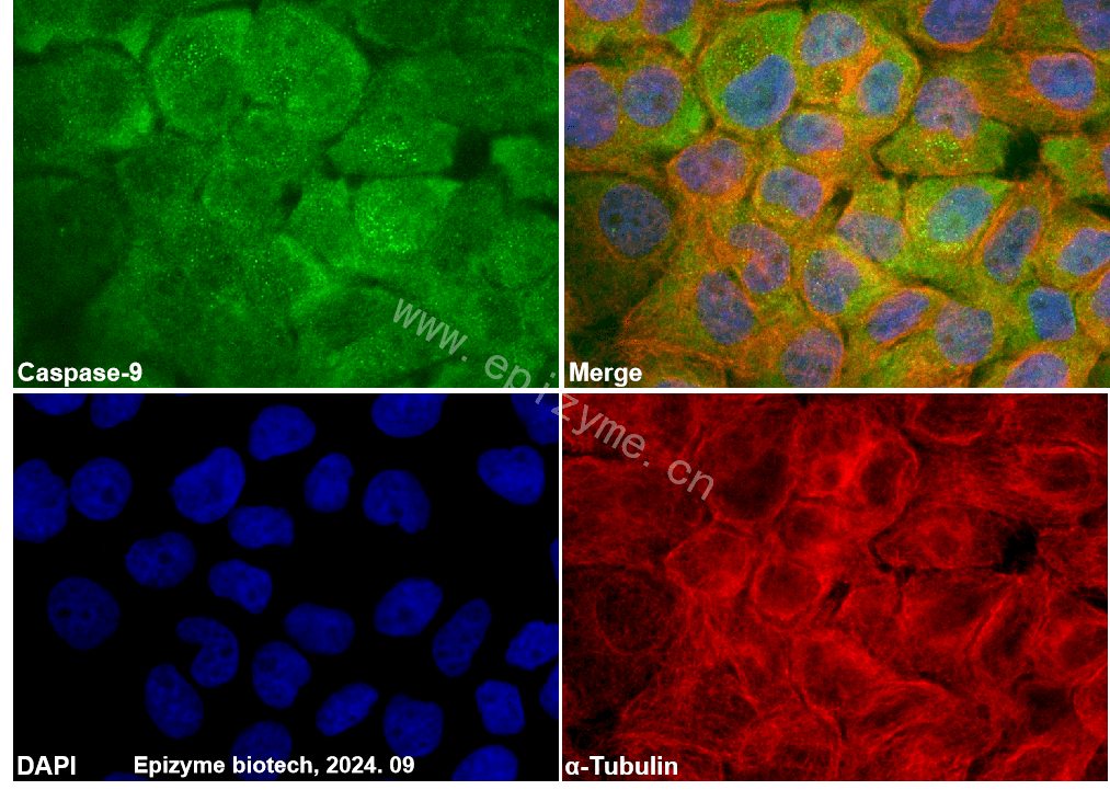 Anti-Caspase 9 Rabbit mAb [80M82L11]
