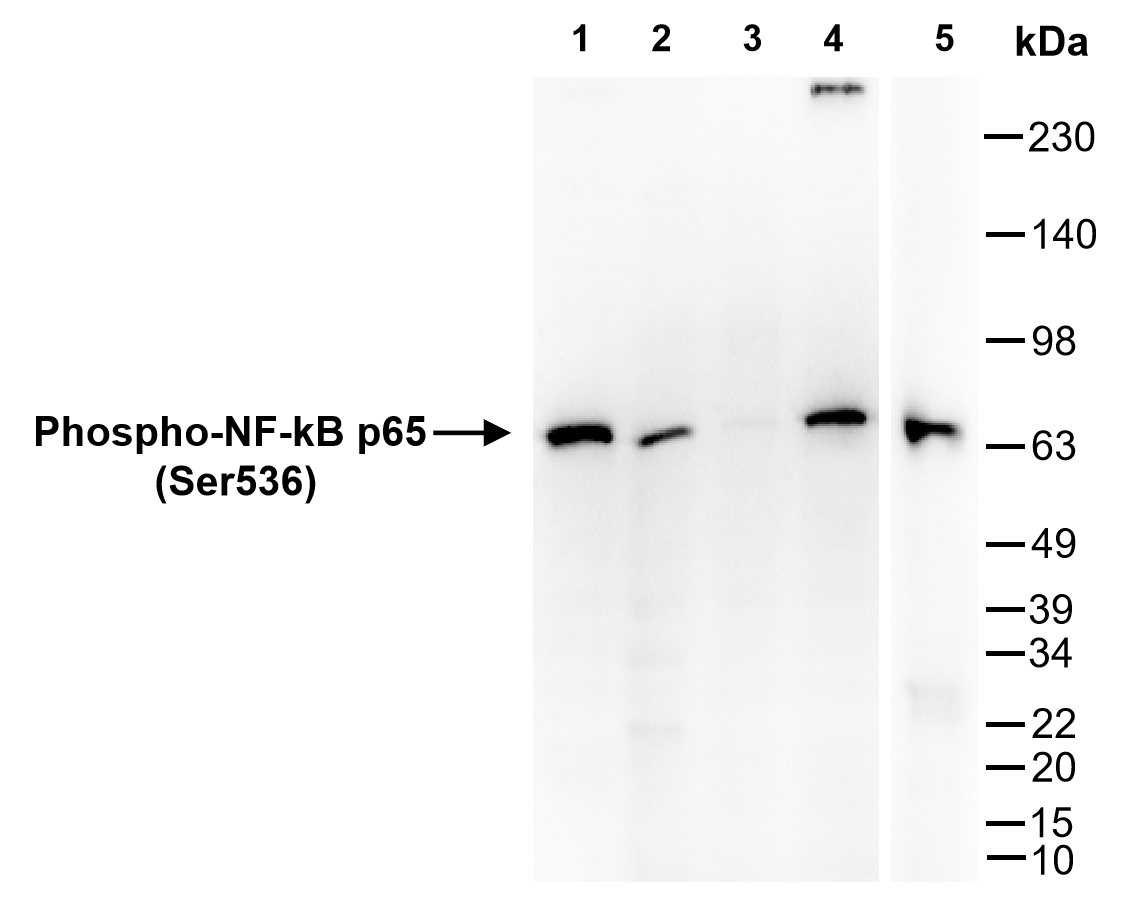 Anti-Phospho-NF-kB p65 (Ser536) Rabbit mAb [12L74M11]