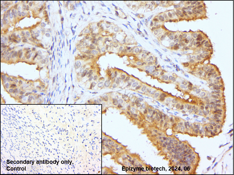 Anti-Phospho-NF-kB p65 (Ser536) Rabbit mAb [12L74M11]