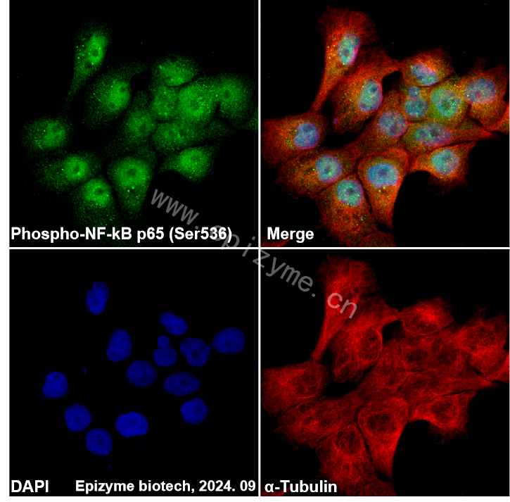 Anti-Phospho-NF-kB p65 (Ser536) Rabbit mAb [12L74M11]
