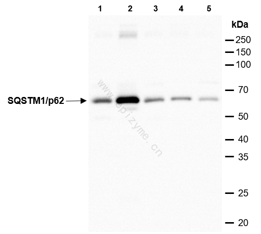 Anti-SQSTM1/p62 Rabbit mAb [53N86E71]