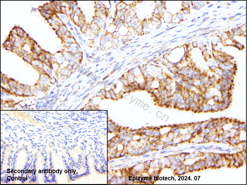 Anti-SQSTM1/p62 Rabbit mAb [53N86E71]