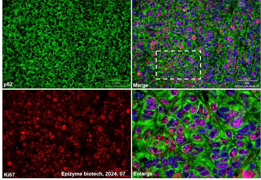 Anti-SQSTM1/p62 Rabbit mAb [53N86E71]
