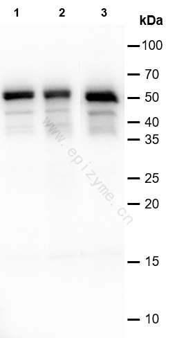 Anti-Caspase 1 Rabbit mAb [83H99E42]