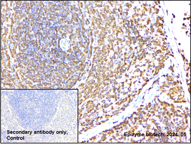 Anti-Caspase 1 Rabbit mAb [83H99E42]