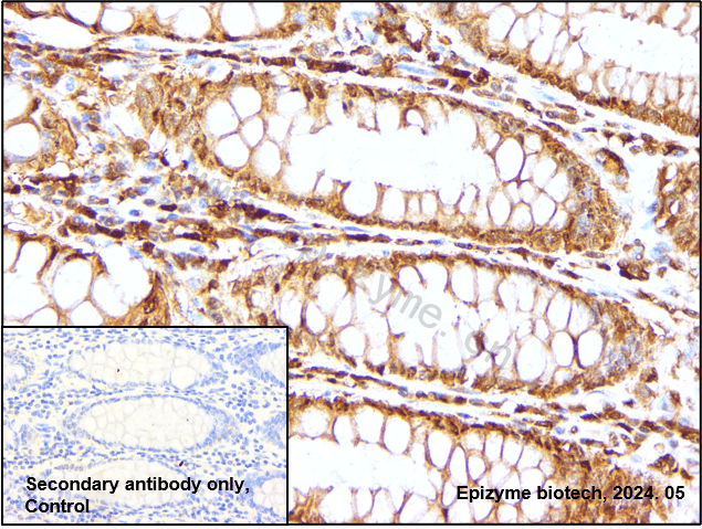 Anti-Caspase 1 Rabbit mAb [83H99E42]