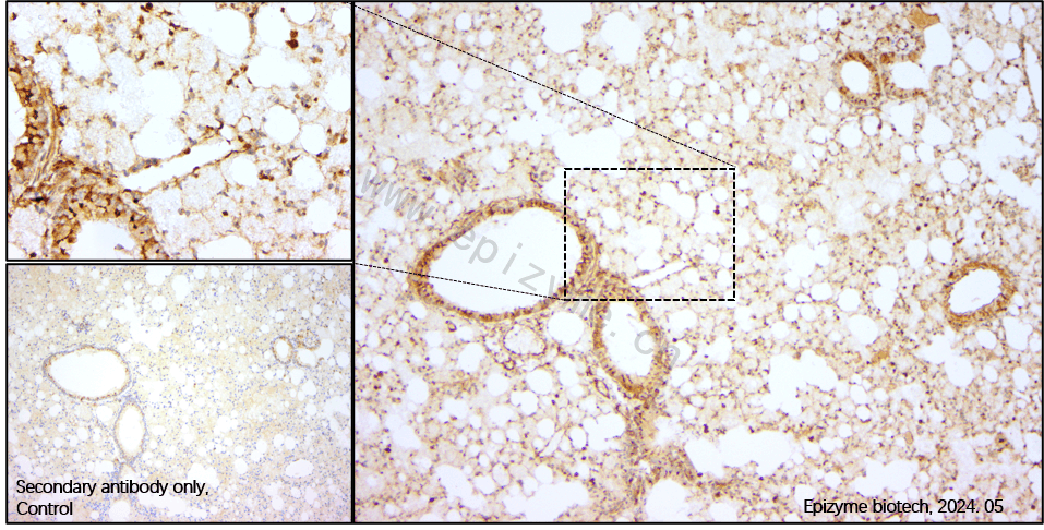 Anti-Caspase 1 Rabbit mAb [83H99E42]