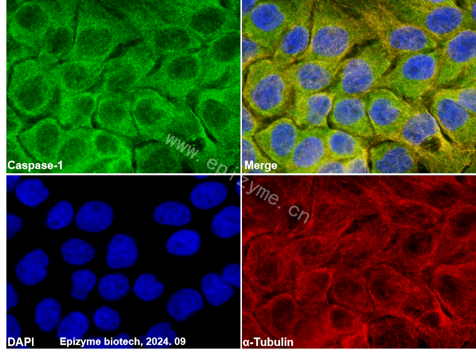 Anti-Caspase 1 Rabbit mAb [83H99E42]