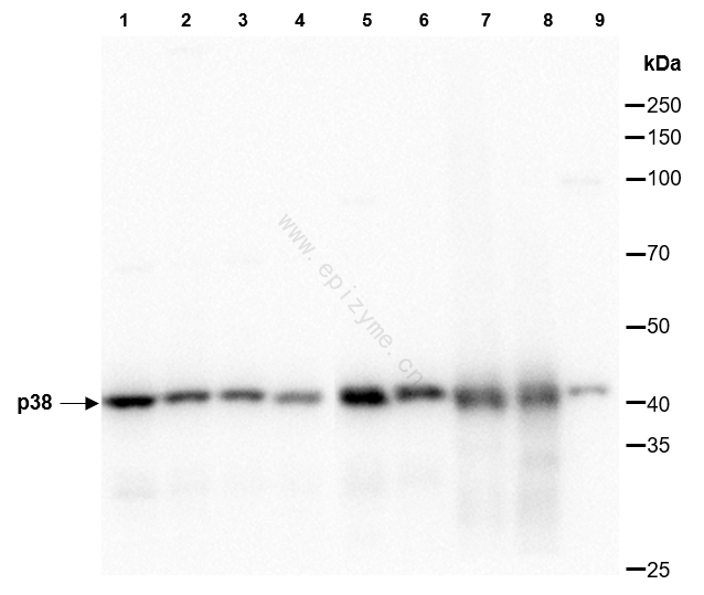 Anti-p38 Rabbit mAb [49C01B92]