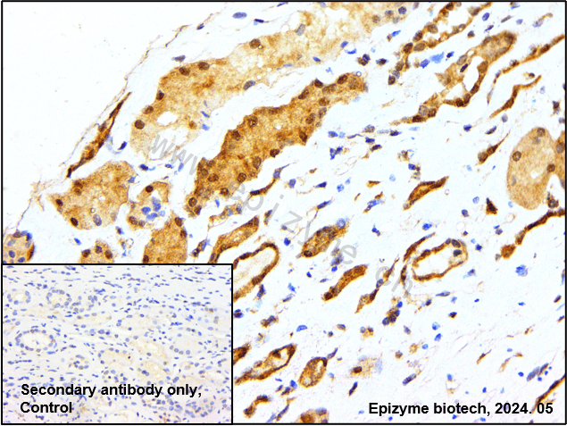 Anti-p38 Rabbit mAb [49C01B92]