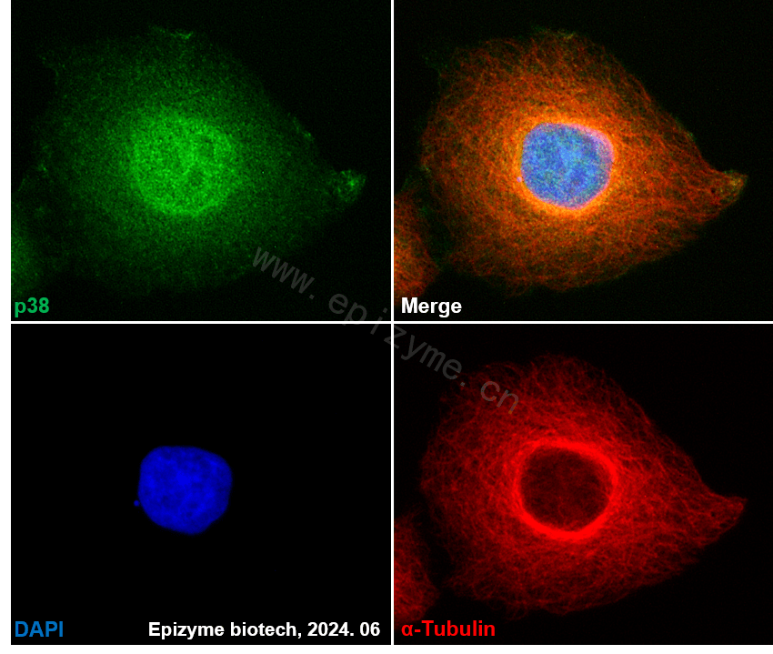 Anti-p38 Rabbit mAb [49C01B92]