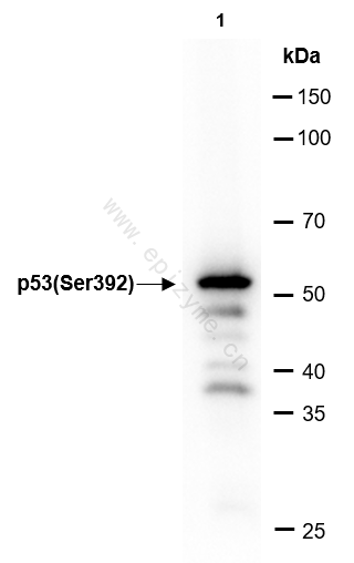 Anti-Phospho-p53 (Ser392) Rabbit mAb [42M92C19]