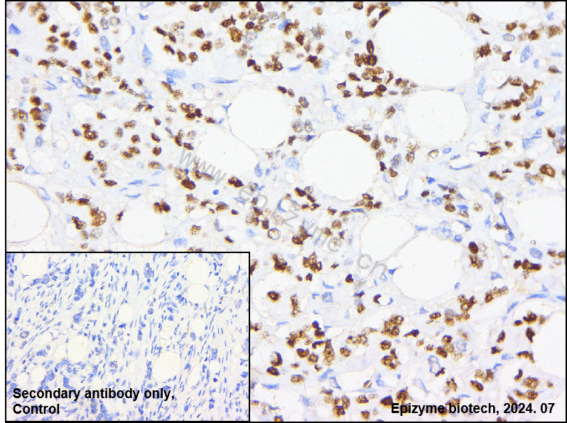Anti-Phospho-p53 (Ser392) Rabbit mAb [42M92C19]