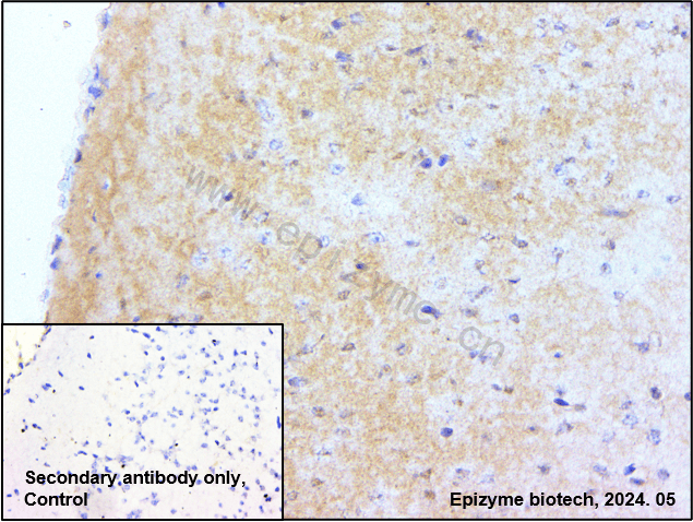 Anti-PAK3 Rabbit mAb [11R93I97]