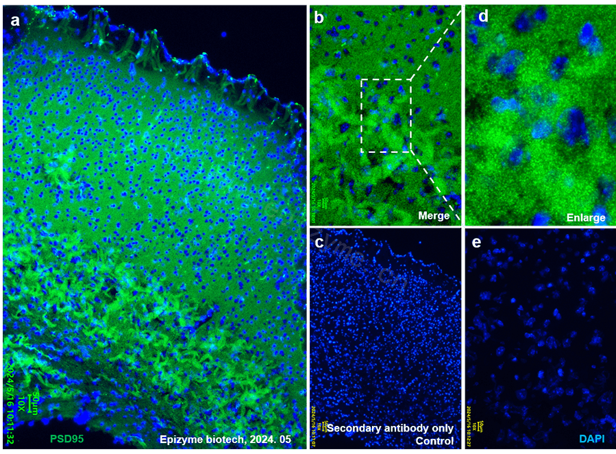Anti-PSD95 Rabbit mAb [21E45F92]
